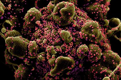 Лекарство от рака применят для борьбы с коронавирусом