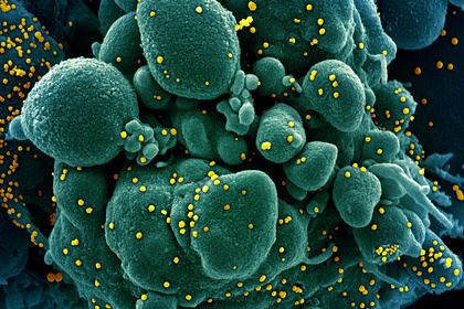 В США одобрили проведение домашних тестов на коронавирус по слюне